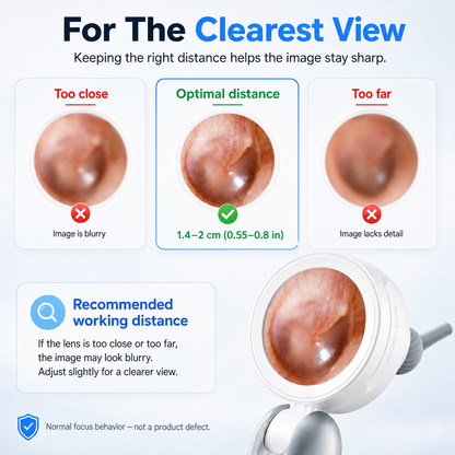 Ayvor™ Otoscope Ear Camera